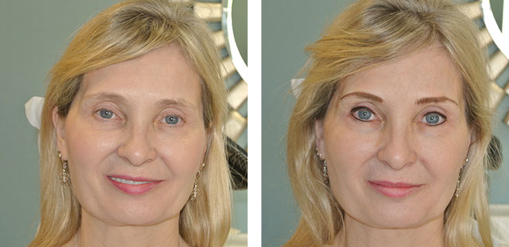 Before and After - Eyebrows & Eyes