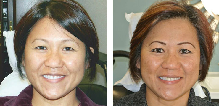 Before and After - Eyebrows & Eyes