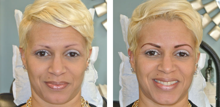 Before and After - Eyebrows & Eyes