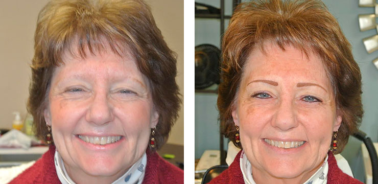 Before and After Photo - Permanent Cosmetics of Maryland